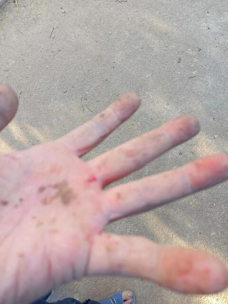 红薯汁弄到手上怎么洗掉_洗面奶搓红薯渍，沙子醋柠檬辅助，注意保湿防过敏