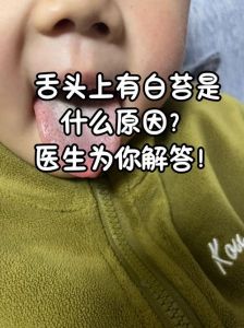 舌头上的白色物质怎么清理_保持口腔卫生，早晚刷牙，饮食清淡，戒烟限酒
