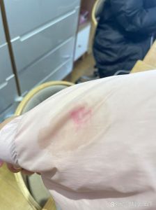 甲油胶滴衣服上怎么洗掉_洗甲水酒精醋，502香蕉水除，注意材质防损坏