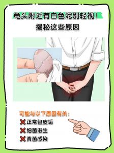 包鸡屎的部位是什么器官_嗉囊堵塞鸡胗功能与鸡屎包解析