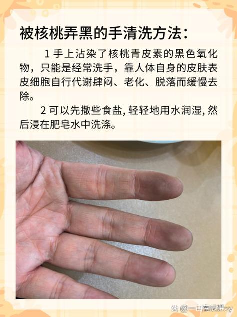 生核桃的汁水搞到手上怎么洗_生核桃汁染色？柠檬牙膏来帮忙！