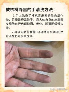 生核桃的汁水搞到手上怎么洗_生核桃汁染色？柠檬牙膏来帮忙！