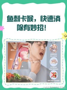 被鱼刺卡了怎么办_鱼刺卡喉？别吞馒头，快咳嗽就医！