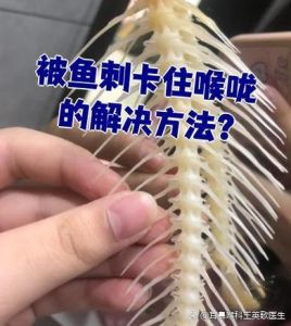喉咙卡了鲫鱼小刺会自己消失吗_喉咙卡鱼刺别大意，及时就医是关键！