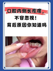 口腔有腐臭味怎么回事_卫生饮食疾病都有关