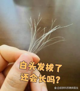 毛发拔了还会长出来吗_拔头后毛发能再生吗？