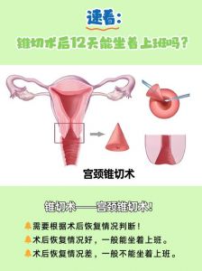 宫颈锥切手术图解_检查宫颈癌变，术后注意复查
