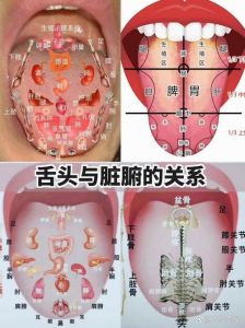 舌头与内脏的对应图_不同部位反映脏腑，颜色形态是关键！