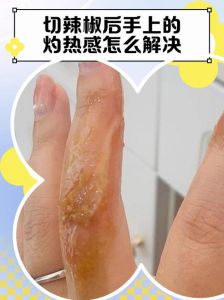 手摸完辣椒后灼热很痛_辣椒手灼烧别揉搓，冷水油奶能解忧
