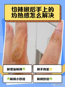 辣椒辣到手灼烧感怎么处理_烫到手？冲凉水，抹醋或护发素！