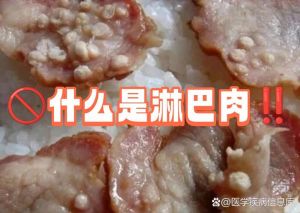 淋巴肉和米粒肉区别_避淋巴肉米猪肉，选鲜红有弹性