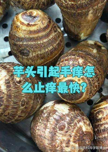 芋头汁液弄到手上发痒怎么办_芋头汁皮肤过敏别抓，温水泡或冷敷缓解