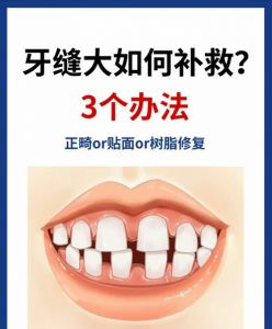 中间牙缝大怎么处理_牙缝大？戴牙套贴面或补牙来矫正
