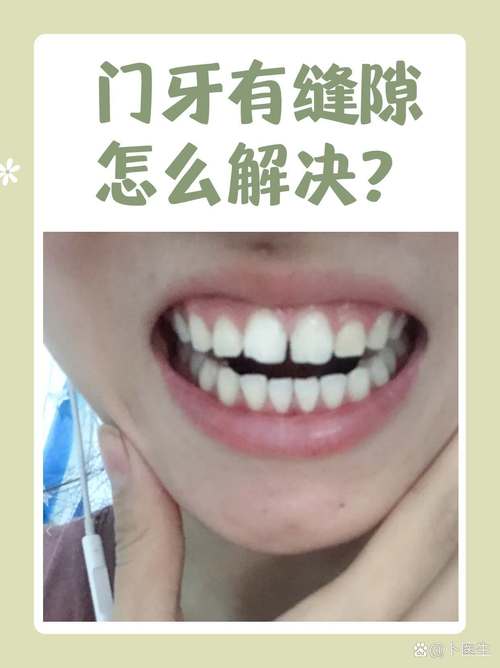 两颗大门牙中间有个缝怎么办_门牙有缝是什么原因？