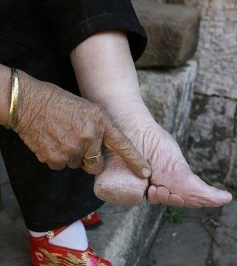 古代什么时候有裹小脚的做法_始于宋代，残害女性肢体的恶习