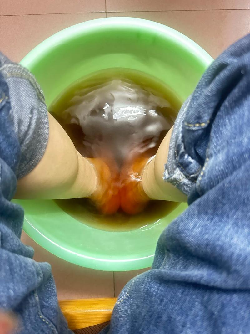 大野芋的汁液怎么洗掉_大野芋汁液刺痒红肿？正确处理方法