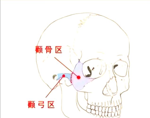 颧骨是哪个部位图片_影响脸型美与功能的重要骨头 颧骨是哪个部位图片_影响脸型美与功能的重要骨头