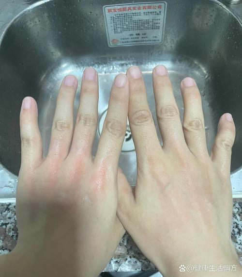 弄了芋头手发痒怎么办_切芋头手痒？戴手套或用醋防痒