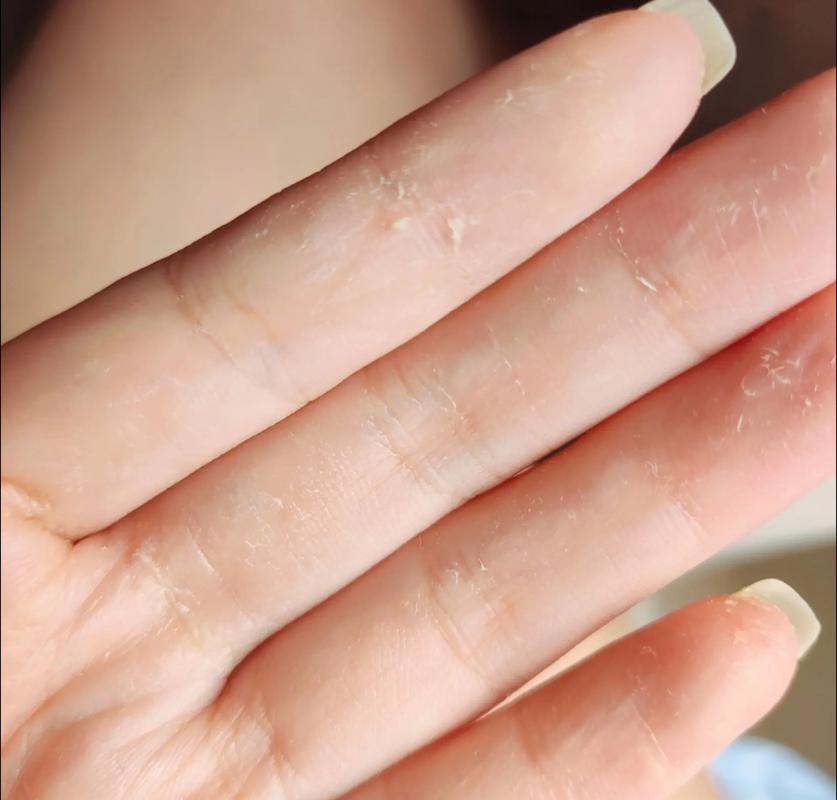 削完红薯皮后为什么手上黏黏的_红薯削后手黏腻？草木灰小苏打搓掉！