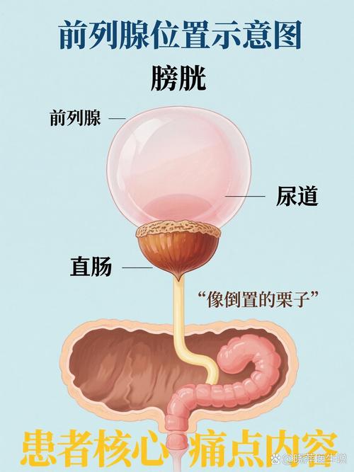 前列腺在哪个部位示意图_前列腺增生困扰中老年,定期检查很重要! 前列腺在哪个部位示意图_前列腺增生困扰中老年,定期检查很重要!