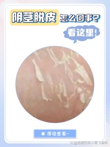 牛口条怎么脱皮_牛口条水煮去皮法，高压锅炖煮易撕，剔除淋巴保卫生