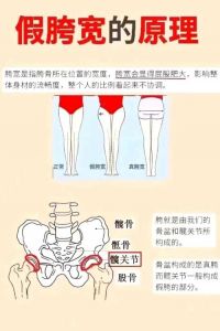 胯骨图片位置图_连接躯干与下肢的关键骨骼